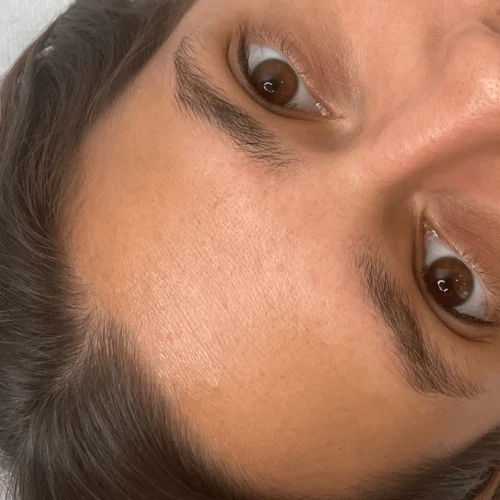 Browlift à Reims - Avant et après le brow lift des sourcils chez Instant Regard